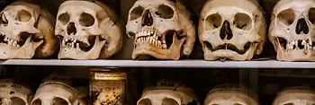 Collection of Anatomical Pathology in the Madhouse Tower